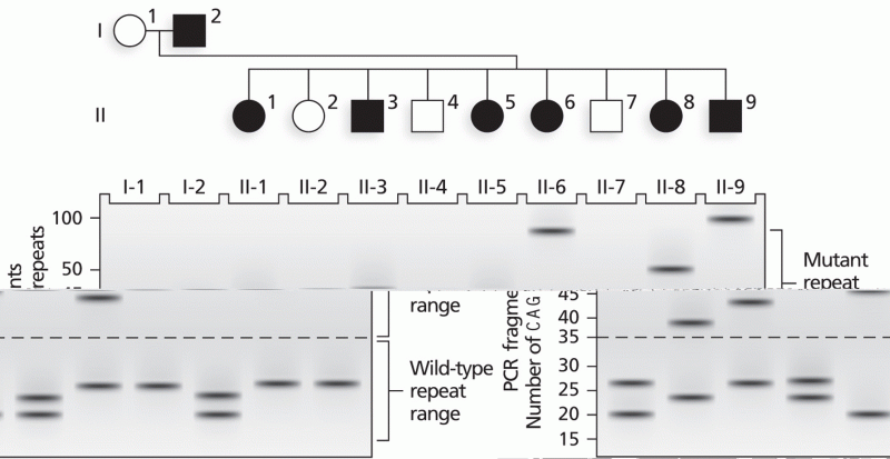 PCR analysis showing expansion of the CAG repeat region of the HD gene