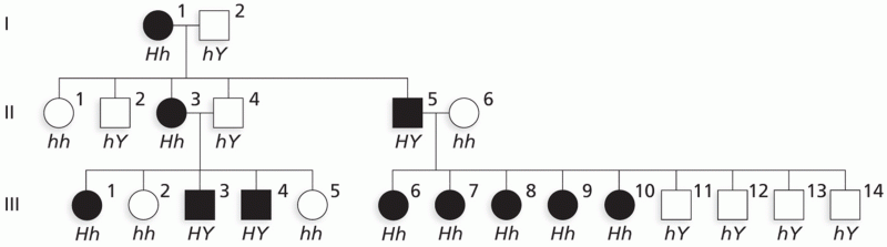 X-linked dominant congenital generalized hypertrichosis (CGH) in a family