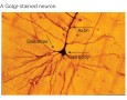 A Golgi-stained neuron