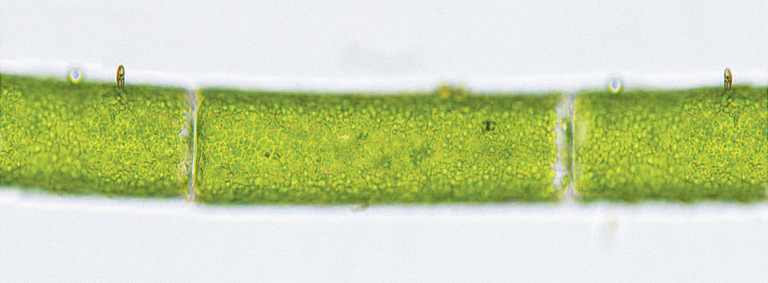 Light micrograph of cells in a strand of Chladophora