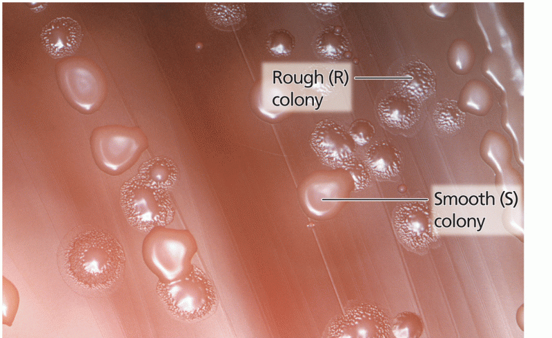 Smooth and rough colonies of Pneumococcus