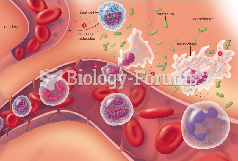 Featured: Example of inflammation as a response to bacterial infection. 