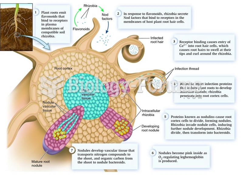 Featured: Root nodule development.