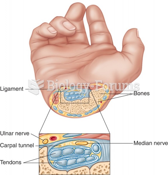 Featured: Cross section of the wrist showing tendons and nerves involved in carpal tunnel syndrome.