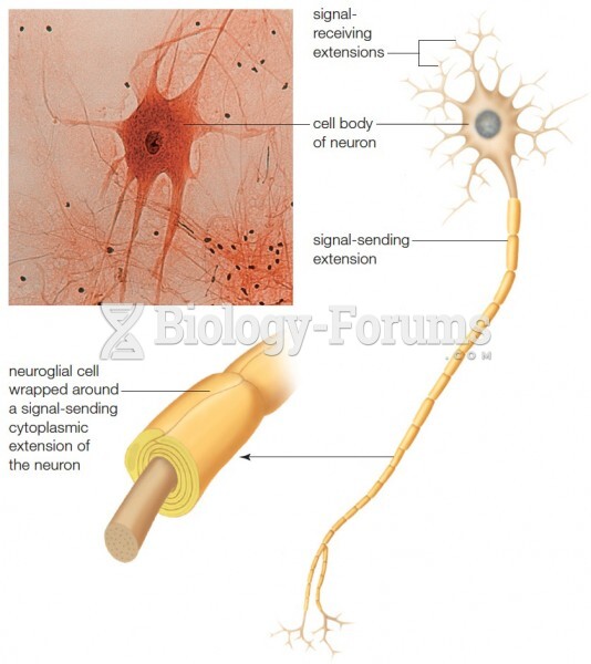 Featured: Micrograph and graphic of a motor neuron