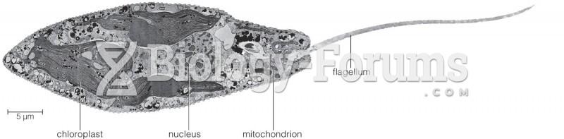 Featured: Electron micrograph of Euglena gracilis